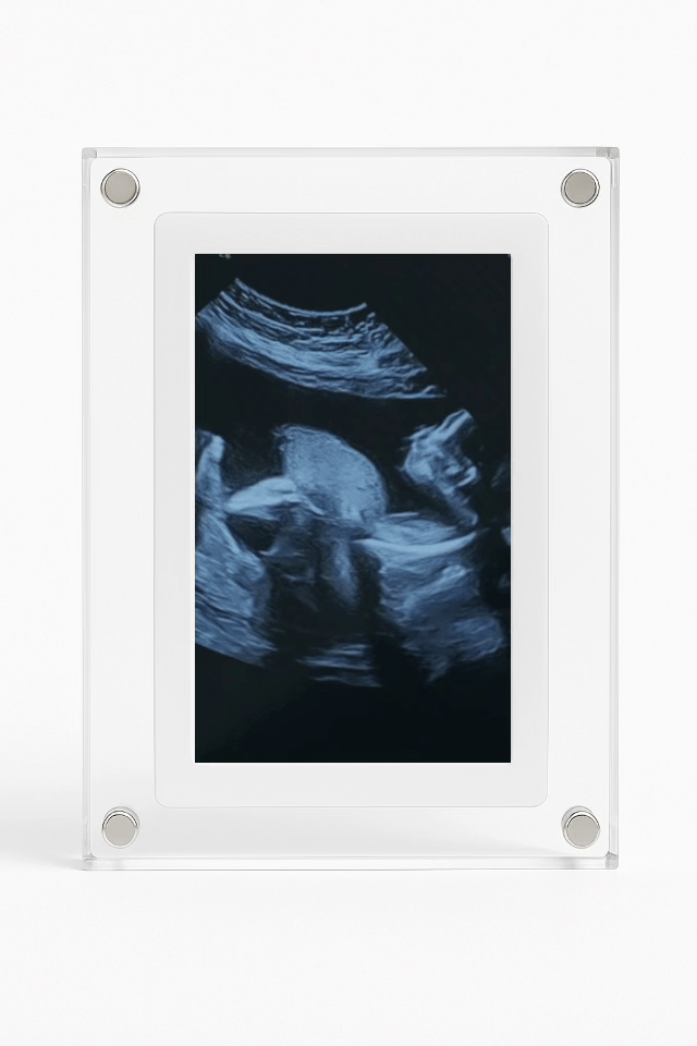 BabyFrame