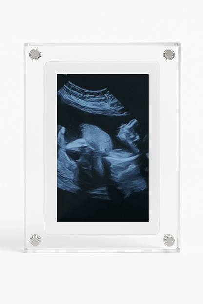 BabyFrame