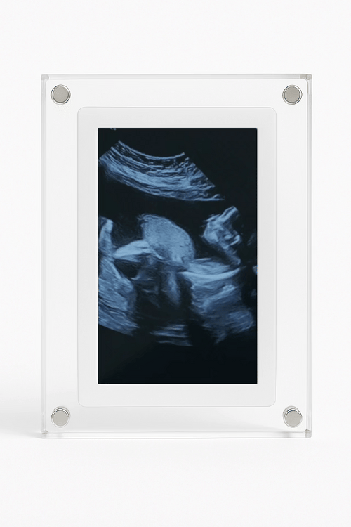 BabyFrame