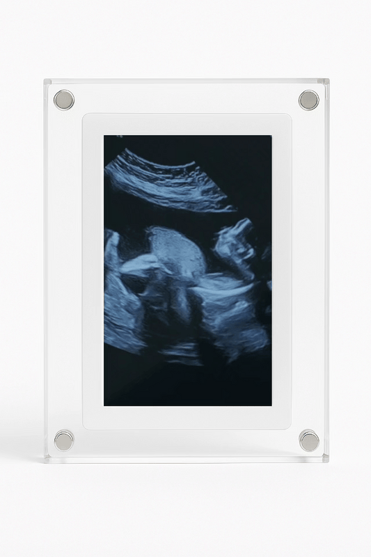 BabyFrame
